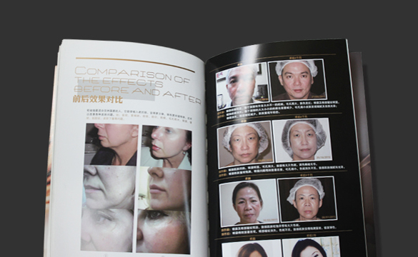 厦门微创美容画册设计、厦门美容整容画册设计